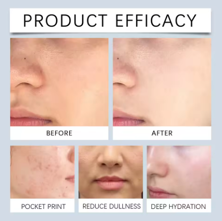 Zero Pore Toner